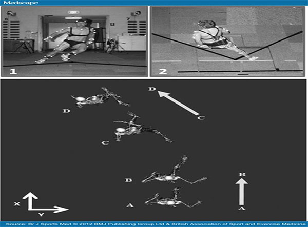 Sidestep cut, movimenti critici per il crociato